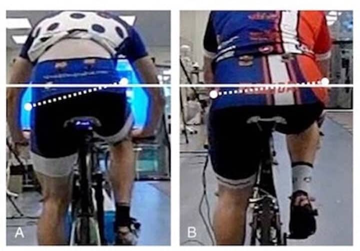 douleur derriere genou velo