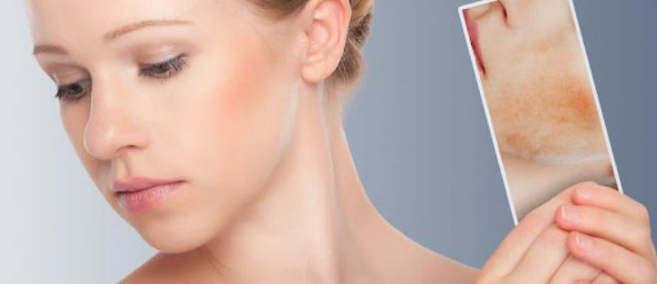 meilleur creme anti tache