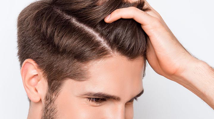 Meilleur Effluvium Cheveux